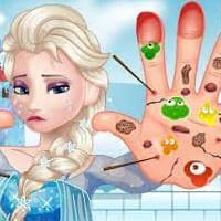 Elsa Foot Injured